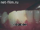 Фильм Комплексная система профилактики в стоматологии.. (1985)
