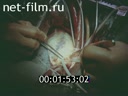Film Artificial blood. Biophysical approach to the problem. (1984)