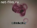 Newsreel Want to know everything 1981 № 139