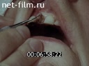 Film Outpatient dental surgery. (1987)