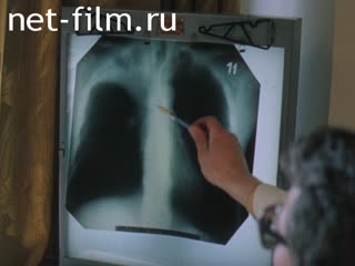 Фильм Диагностика и лечение рака лёгкого.. (1986)