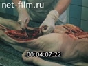 Фильм Судебно – медицинская экспертиза механической асфиксии.. (1990)