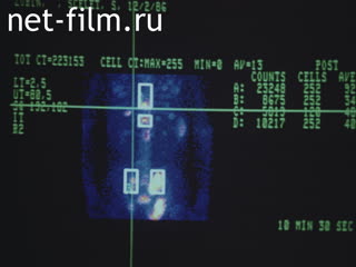 Film Diagnosis and treatment of tumors of the musculoskeletal system.. (1987)